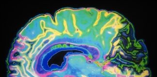 Study isolates the changes in pain-related brain activity following mindfulness training