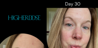 Does Red Light Therapy Fix Dark Spots and Hyperpigmentation? – HigherDOSE