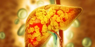 Scientists finally reveal the hidden mechanism linking alcohol to fatty liver